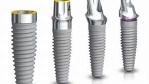 Implant post material