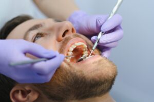 Important Considerations for Dental Implants