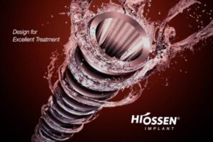 Unique Structure of Hiossen Implant