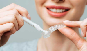 Essential Considerations for Philips Zoom Teeth Whitening