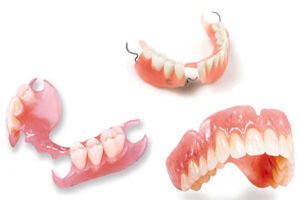 What Are Removable Dentures?