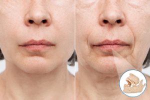 Aesthetic Impacts of Missing Teeth