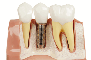 High Treatment Costs