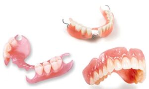 Removable Dentures