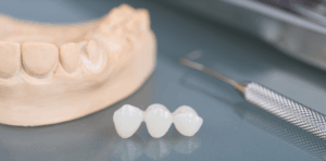 The Type of Dental Material You Choose